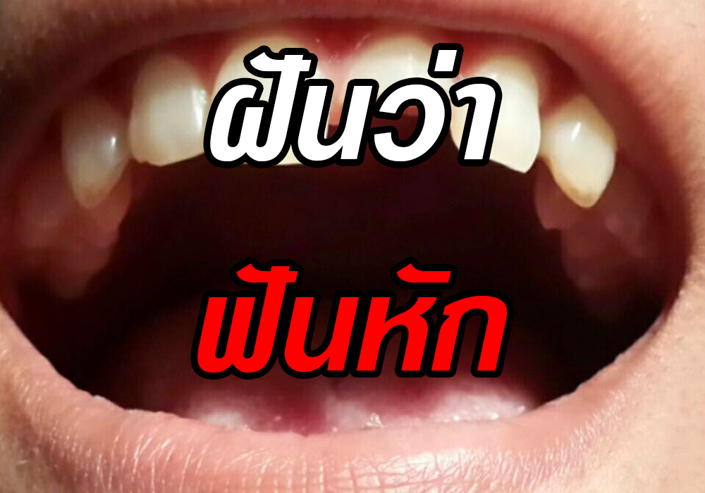 ทำนายฝัน เมื่อฝันว่าฟันหัก